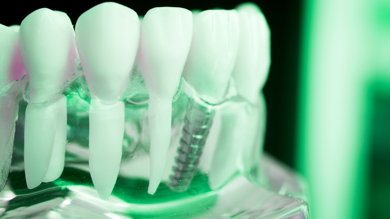 The Impact of 3D Printing in Dental Prosthetics: A Game Changer