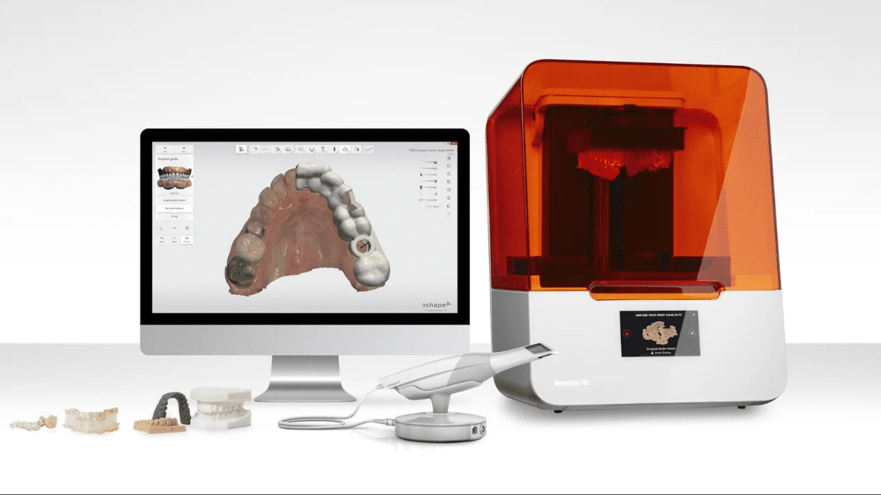 Know Benefits of Intraoral Scanner for Digital Impression